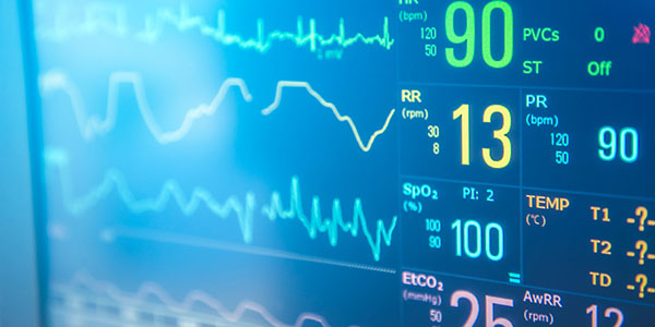 Parametri da controllare